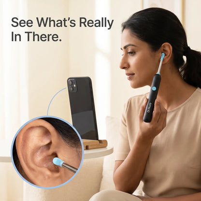 VisioEar: Doctor Approved Ear Health Technology