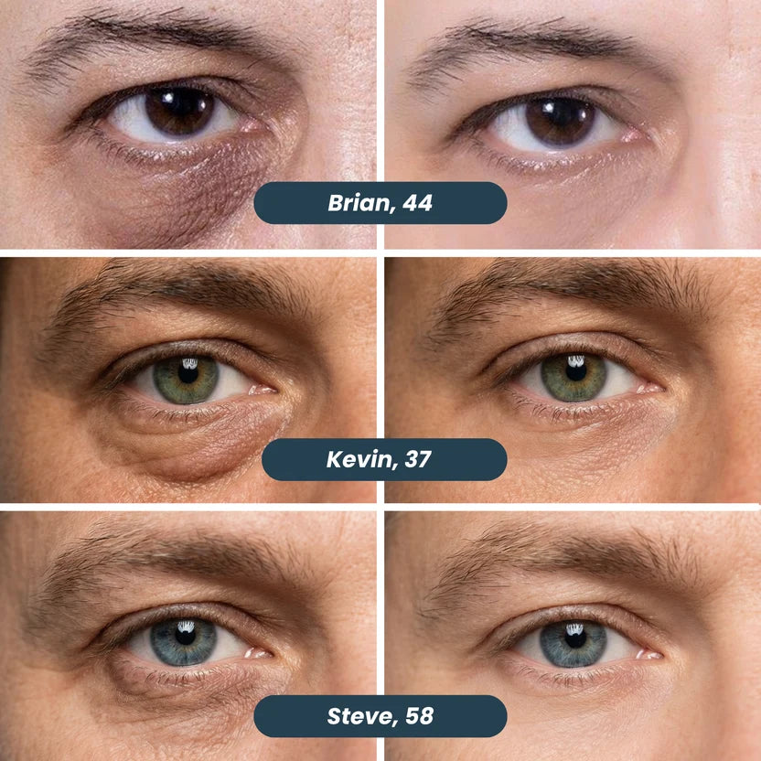 Orena Peptide-8 Micro-Infusion Eye Patches for Men