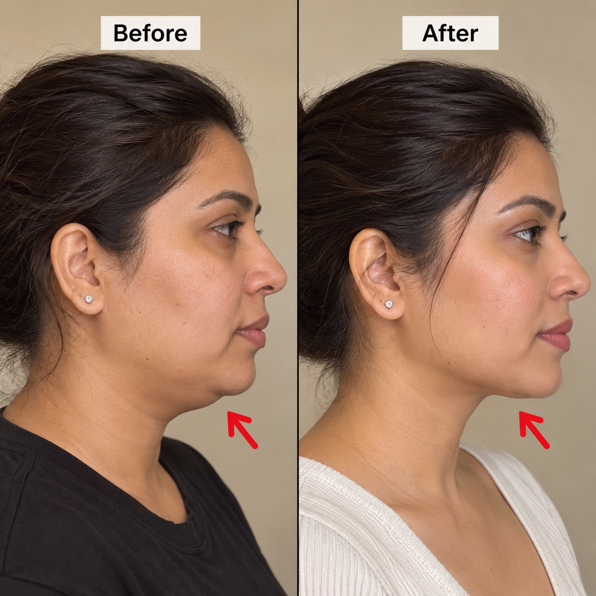 SKULT™ KOREAN COLLAGEN FACE SCULPT WRAP
