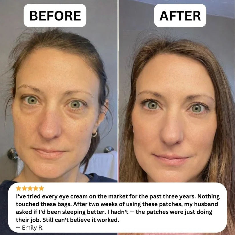 Korean Peptide-8 Micro-Infusion Eye Patches - For Eye Bags, Dark Circles and Fine Lines